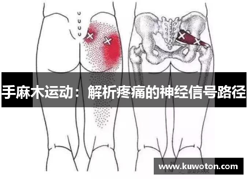 手麻木运动:解析疼痛的神经信号路径 手麻木运动:解析疼痛的神经信号路径